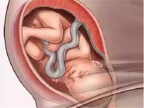 胎儿入盆会有什么表现（胎儿有点入盆到完全入盆的时间）-第4张