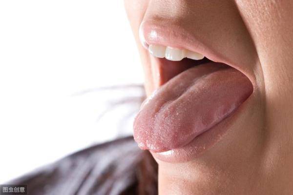 舌头上的脏东西吗，舌头上的舌苔是白色的怎么去除-第2张