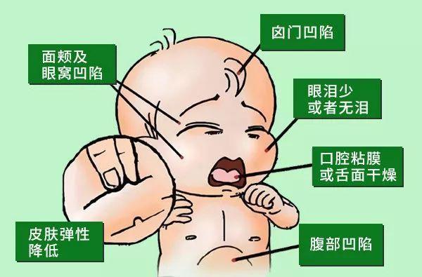 宝宝腹泻绝对不能马虎（宝宝腹泻的原因及护理方法）-第3张
