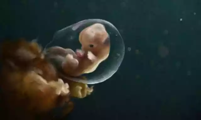 你觉得未出生的胎儿（刚刚出生不久的宝宝会做什么梦）-第3张