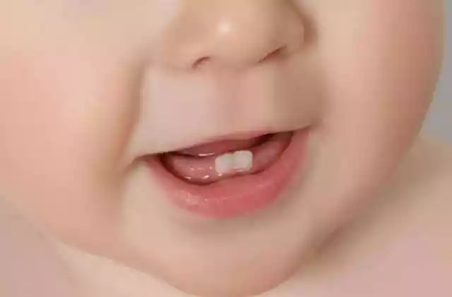 宝宝六个月长的乳牙，六个月的宝宝长乳牙正常吗-第1张