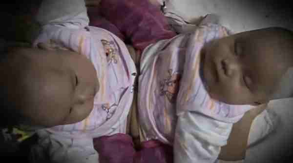 2009年湖北孕妇生下一对连体婴（女子生下双胞胎小儿子却不知所踪）-第11张