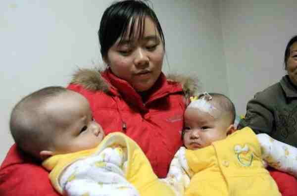 2009年湖北孕妇生下一对连体婴（女子生下双胞胎小儿子却不知所踪）-第9张